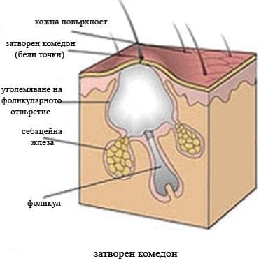 Основные невоспалительные поражения кожи