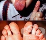 �������� � ������������