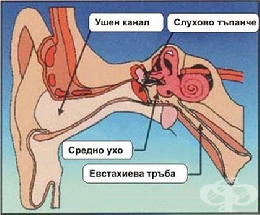 видове отит възпаление на ухото