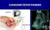 Сонохистерография