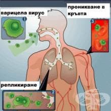 Колко трае инкубационният период при варицела?