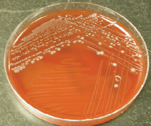 clostridium agar
