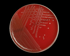 enterococcus-faecalis