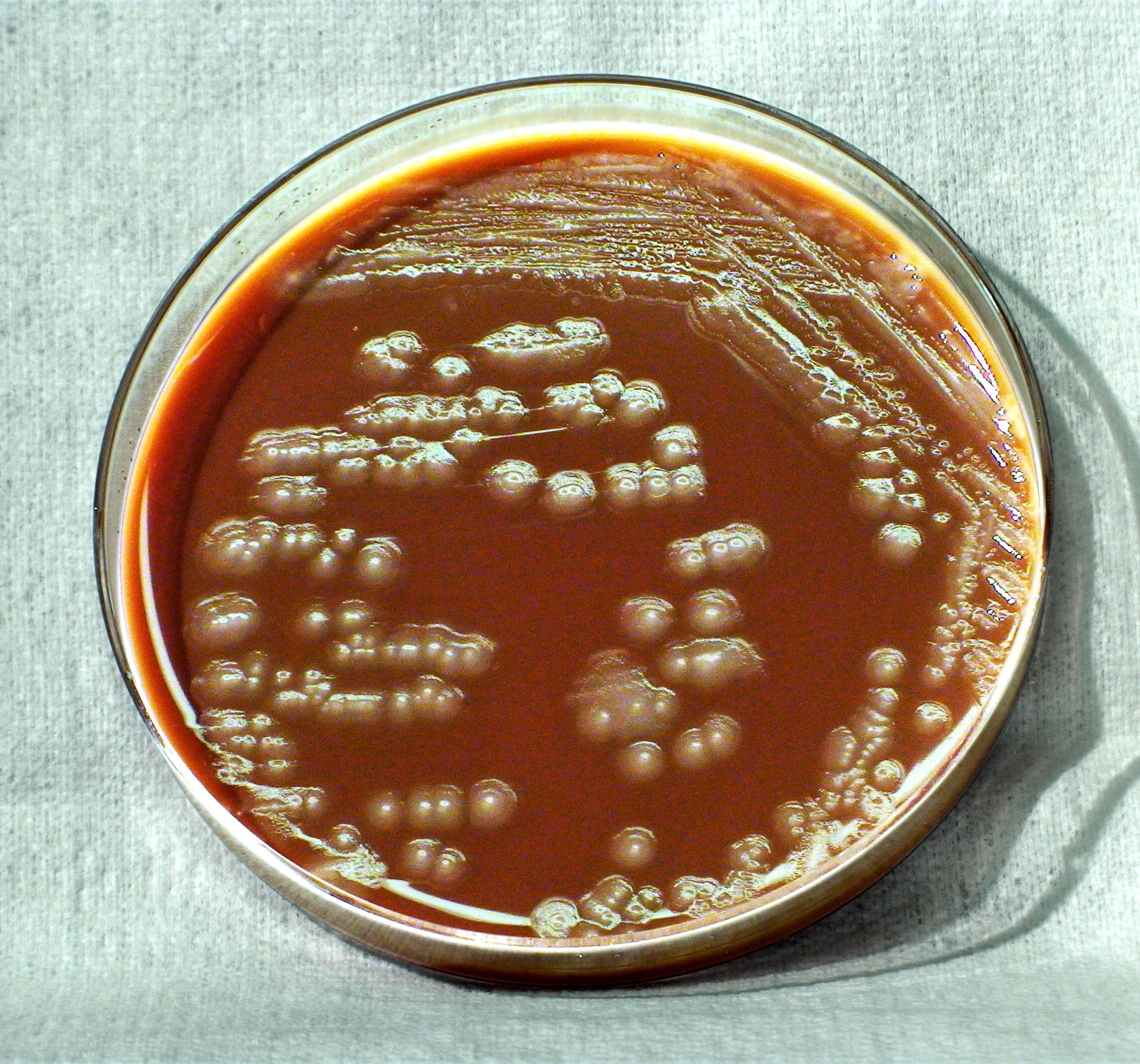      Yersinia pestis