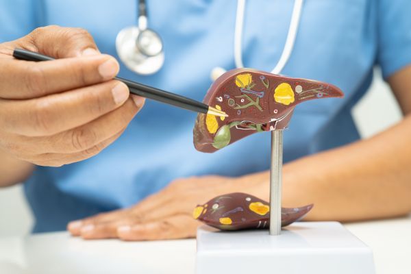 Експерименталното лекарство намалява натрупването на мазнини и възпалението в черния дроб Черен дроб