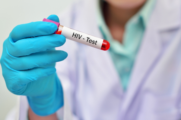   ,      HIV
