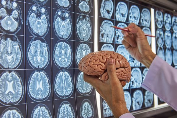 Мъжкият мозък се свива по-бързо с напредване на възрастта от женския Сканиране на мозък