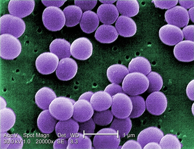 S. aureus-      