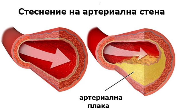 ���������������� �����