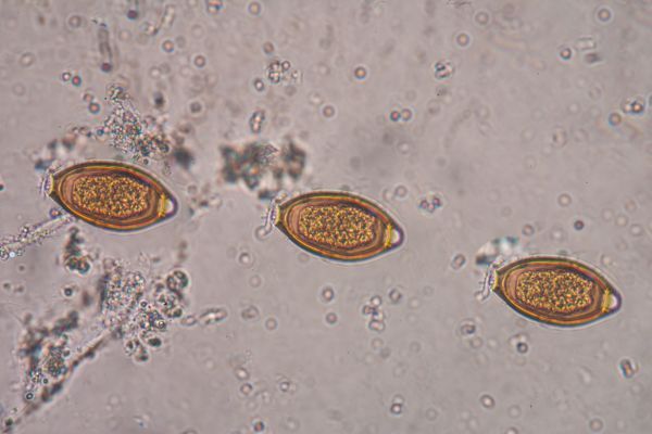 Шистозомиазата се причинява от паразити от род Шистозоми паразити