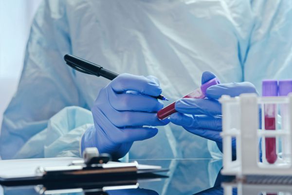 Кръвен тест, измерващ циркулиращата туморна ДНК, може да подобри лечението на рак на гърлото Кръвен тест