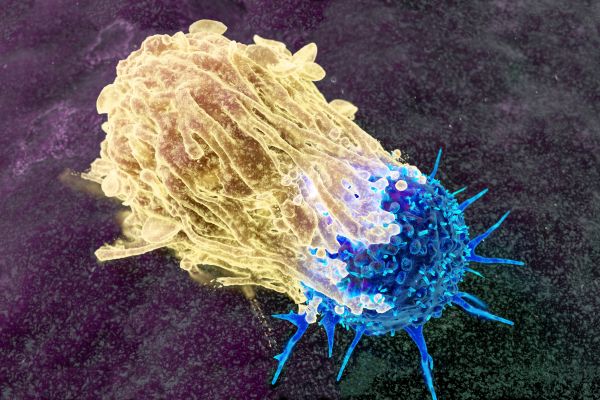 ��� �� ���������