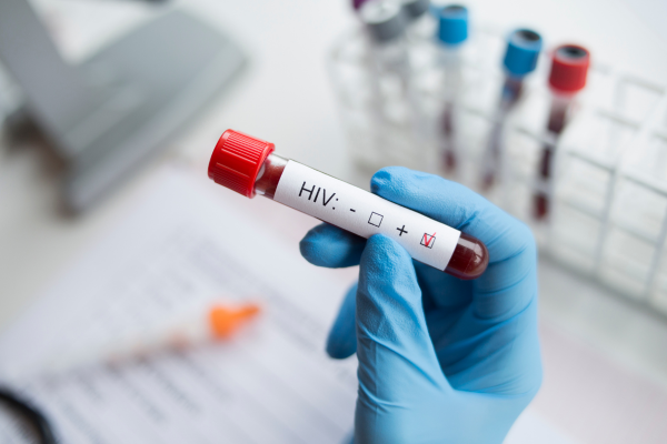 ��������� � ������ HIV