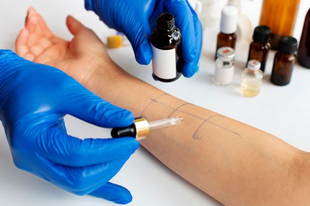 Prick test