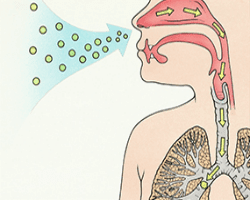 aspergilloma aspergilloma