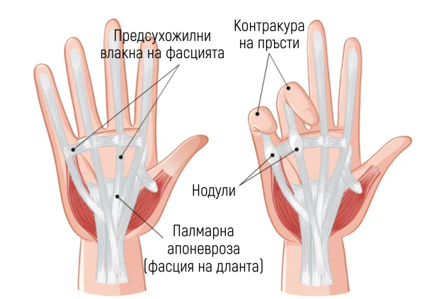 ����� �� �������� �� �������� ��� ������ �� ���������