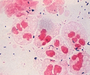 hlamydia trachomatis