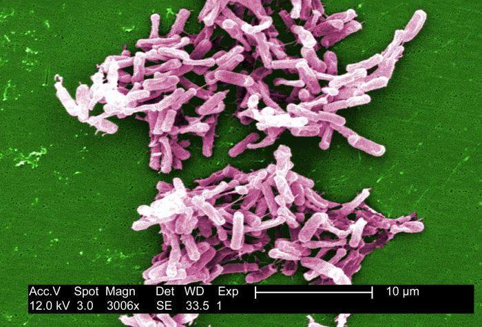 Clostridium difficile Clostridium difficile