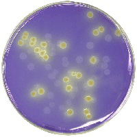 clostridium agar