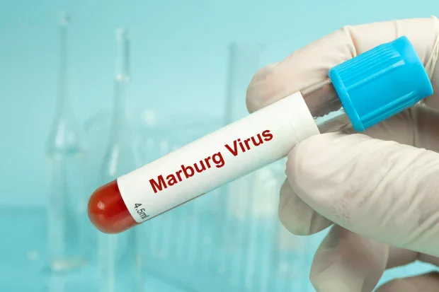 Диагноза и изследвания за Марбург вирус Диагноза и изследвания за Марбург вирус