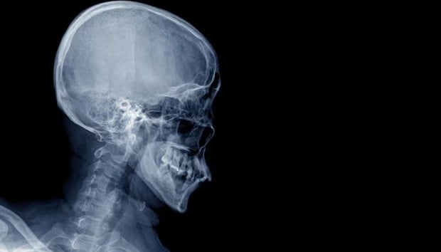 Рентгенография на глава