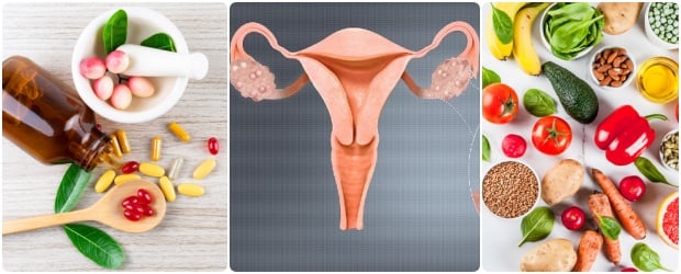 Лечение при поликистозни яйчници: овладяване на отделните симптоми с помощта на билки, диета, лекарства и алтернативни методи