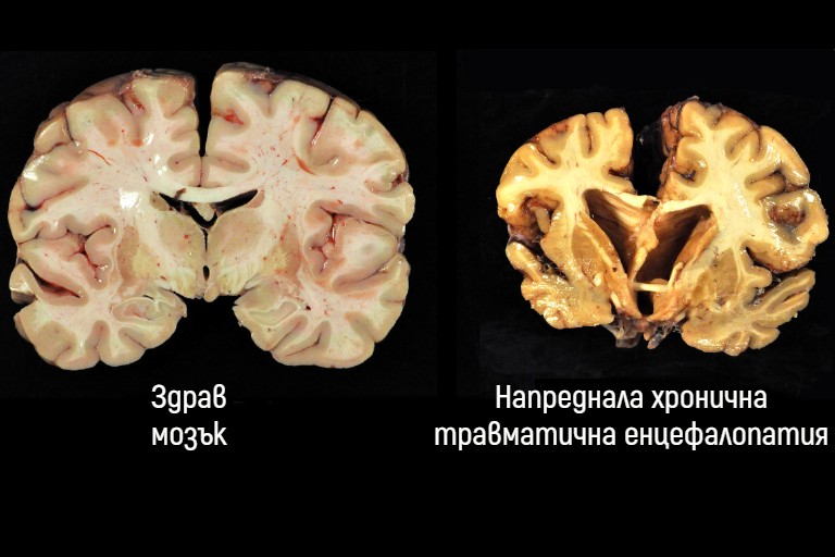 ���������� �������� ����������� �������������