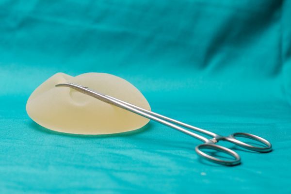 Имплантите с полиуретаново покритие са свързани с по-нисък риск от усложнения след реконструкция на гърдата Гръден имплант