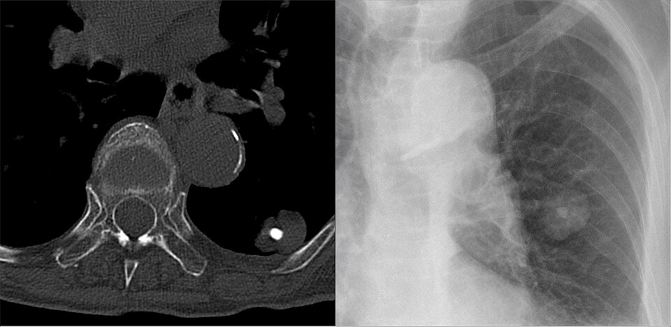 ������� ����������� �� ��������