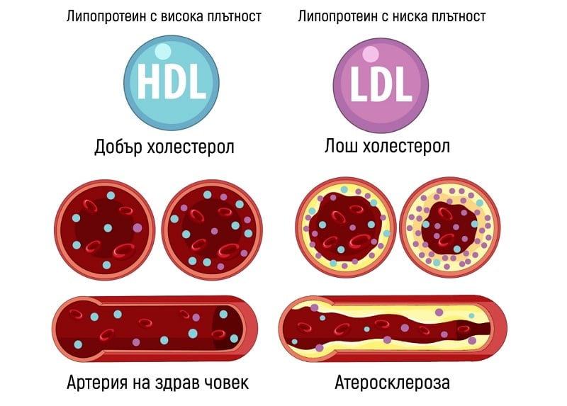 Hdl()  Ldl() 