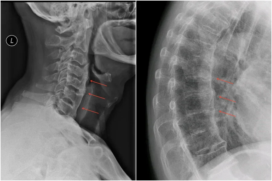 �������������� ��� ��������� ��������, ��������� �����������