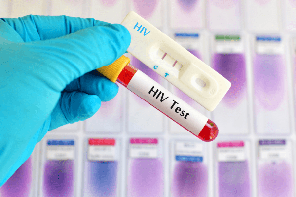    ,     HIV