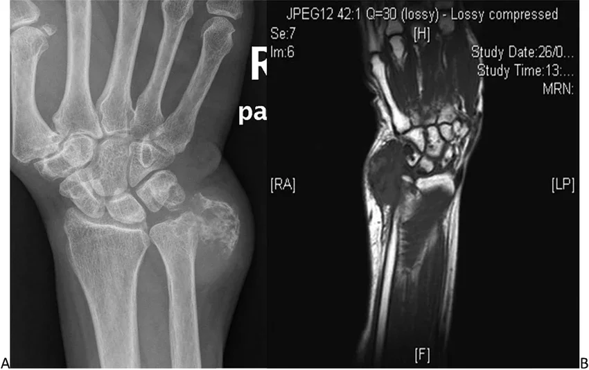 �������������� � ��� ��� ������� �� ������