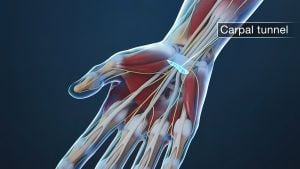 Licensed by https://www.istockphoto.com/photo/tendon-and-nerve-in-the-hand-gm1387943997-445730951