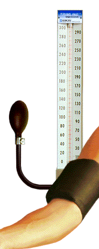 Измерване на артериално налягане