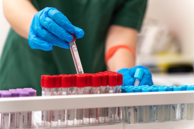 Изледване при ниска алкална фосфатаза Изледване при ниска алкална фосфатаза