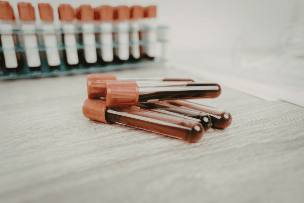 Нов кръвен тест можге да открива проказа преди заразеният да е проявил симптоми епруветки с кръв