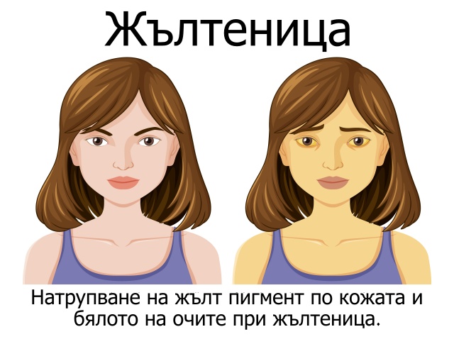 ���������, ��� ����� ��������� ������ �� �����