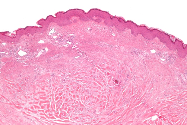 ���������� �� ������