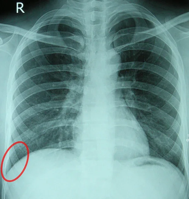 �������� ������-�������������� ������ ��� - ������� ��� ����