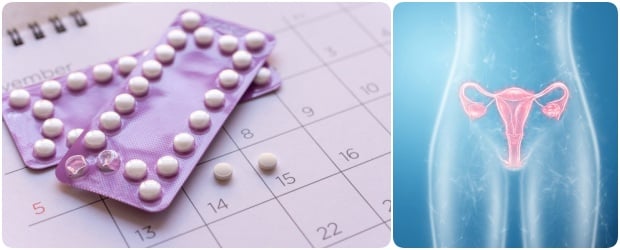 Лечение при поликистозни яйчници: регулиране на менструалния цикъл с помощта на противозачатъчни средства, хормони и други лекарства