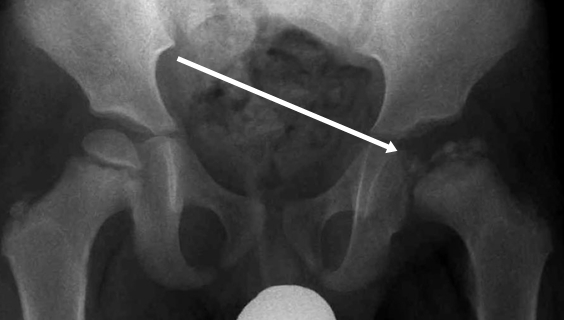 ������ �� ������, ����� ���� �� ������ �� ��������� ��� ����