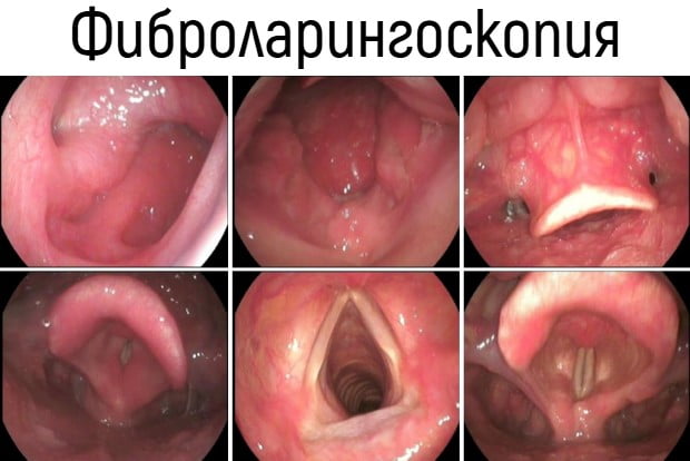 �������� �� ���
