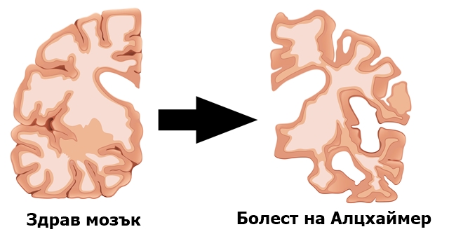 ������� ����������� ��� ���������