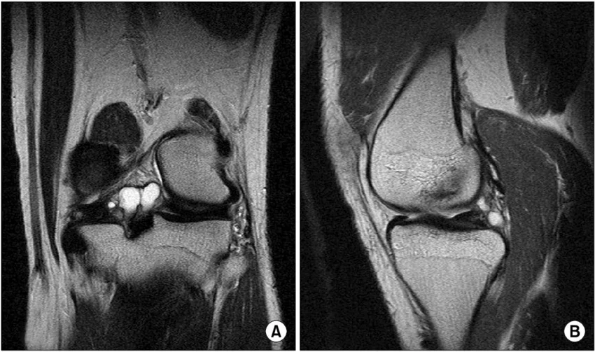 ������-�������� ��������, �������� ���������� �� �������� � �����