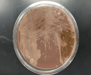 mycobacterium mycobacterium