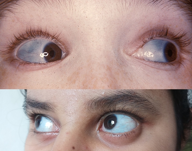 ���� ������ ��� ��