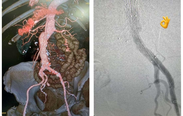 �� ����� �� ���������� ����������� �� ������� � �� �������� ������� ���� ���������, ���� ���� ������� ���������� ���������, ������������ �� ������ ���������� ���������, �������� �� �������������� � CO2 � ������������, � ����� � ���������� �������������