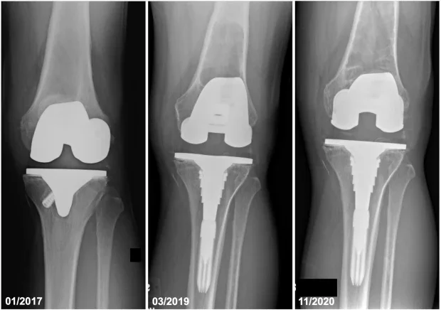 ���������� ������ �� ��������� ���� �������������� �� ��������