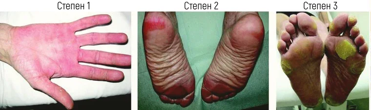 �������� � ���������� ��� ��������-��������� ����������������